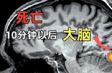 死亡之后，大脑为什么会突然开始高速运转？