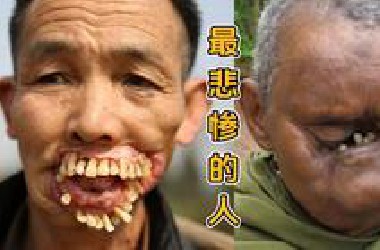 这个男人的牙齿全都长在脸上，把所有村民吓坏了