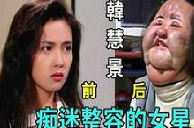 不知道这些女星照镜子的时候，有没有后悔？明明是大美人，却非要整容成僵尸脸