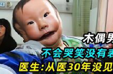 男孩出生自带“木偶面具”，不会哭笑没有表情，医生：从医30年没见过！