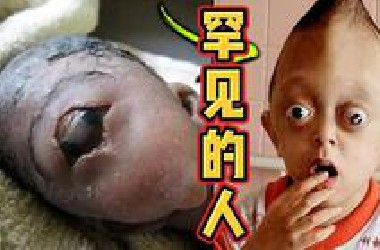10个让你惊讶的罕见奇人