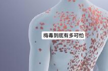 梅毒究竟有多可怕？