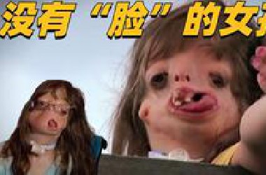 生来就没有脸，5岁时已经接受了29次整容手术。45次手术后的她什么样子？
