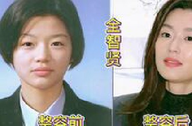10位韩国女星整容前后对比