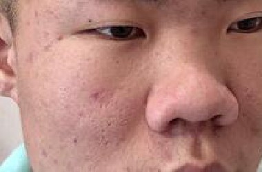 你见过一个鼻子改变整张脸吗？