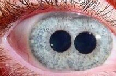 眼睛的颜色可以有多罕见？真的存在双瞳吗？世界上最罕见的眼睛