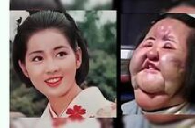 医美失败的明星们，韩慧景脸部注射色拉油，邵音音整形失败
