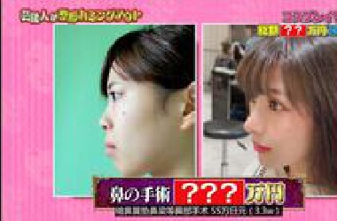 隐瞒已是过去式..日本整容艺人大公开！！