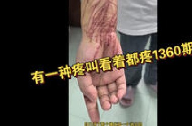 有一种疼叫看着都疼1360期