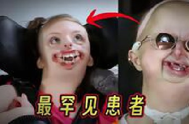 患有这种疾病的人最后都死的很惨