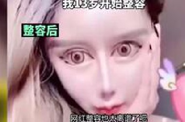 网红整容多离谱？医生让韩安冉脑壳灌水泥，迪丽拉脸上动了108刀