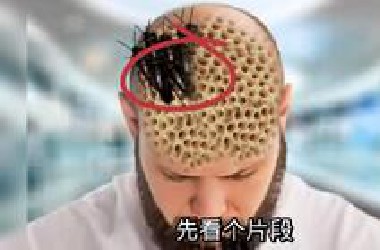哥们睡醒，发现被虫子咬了