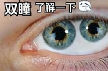 双瞳了解一下，重瞳多个瞳孔的眼睛变异，现实中那些奇怪的眼睛