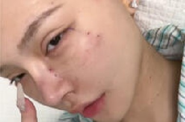 整容使我自信