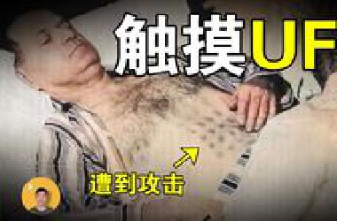 猎鹰湖UFO：目击者留下终身疾病，加拿大证据最多的UFO接触事件【怪奇说】