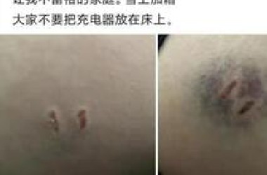 问：被充电器咬了一口需要打什么育苗