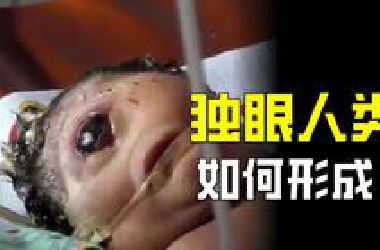 极为罕见的独眼婴儿，为何从出生就注定死亡将至？