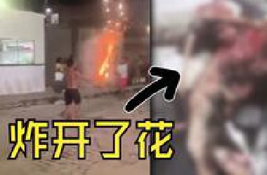 逆天！"精神小伙"手持烟花，结果在手里爆炸，手被炸开了！还能修复吗？【834】