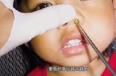 男孩的鼻子内藏匿着一大坨不明生物，挖出后医生都惊呆了。