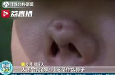 女主播花2万多做"隆鼻修复术"，整完鼻子变4个洞！更过分的是…