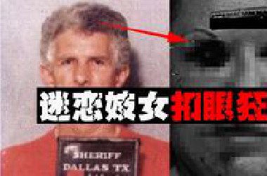 【挖眼癖】把眼球割掉满足自己的XP，只因从小得不到