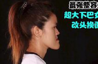 最强整容术，超大下巴的可怜女孩，改头换面变美女
